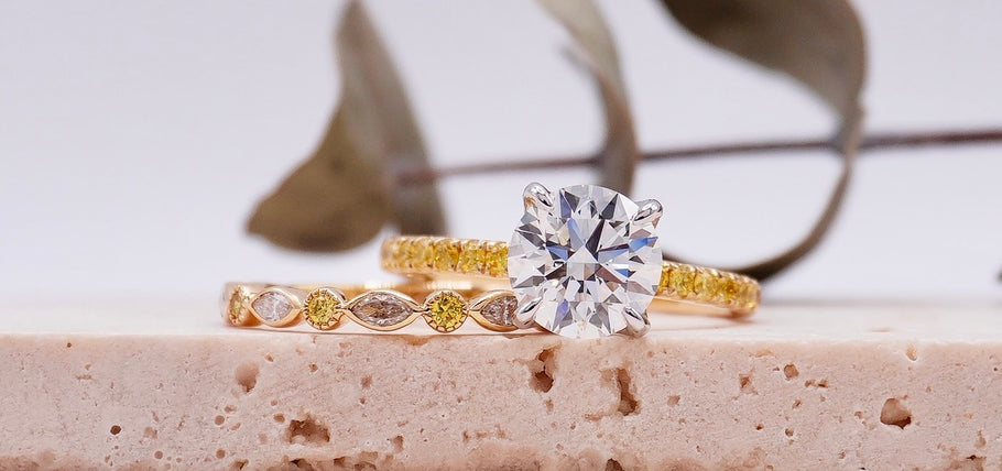 Engagement with Wedding Ring: Traditions, Trends, and Timeless Tips